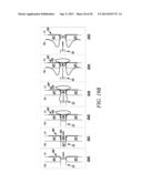 INTRA-ATRIAL IMPLANTS MADE OF NON-BRAIDED MATERIAL diagram and image