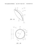 Small Diameter Corneal Inlays diagram and image