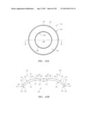 Small Diameter Corneal Inlays diagram and image