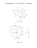 Small Diameter Corneal Inlays diagram and image