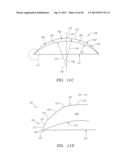 Small Diameter Corneal Inlays diagram and image