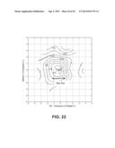 Small Diameter Corneal Inlays diagram and image