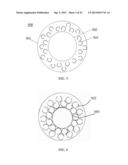 HYBRID BREAST IMPLANT diagram and image