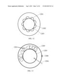 HYBRID BREAST IMPLANT diagram and image