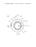 HYBRID BREAST IMPLANT diagram and image