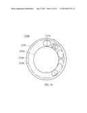 HYBRID BREAST IMPLANT diagram and image