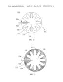 HYBRID BREAST IMPLANT diagram and image