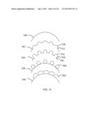 HYBRID BREAST IMPLANT diagram and image