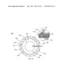 HYBRID BREAST IMPLANT diagram and image