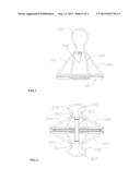 Elastic Clip diagram and image