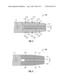 Surgical Tissue Sealer diagram and image