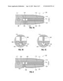 Surgical Tissue Sealer diagram and image