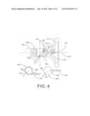 TURBOCHARGER COMPRESSOR INLET FLOW CONTROL diagram and image