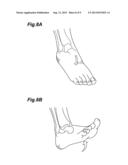 SOCK diagram and image