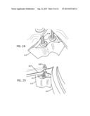 FREE FLOATING INTEGRATED LUG BRIDGE diagram and image