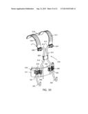 FREE FLOATING INTEGRATED LUG BRIDGE diagram and image