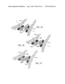 FREE FLOATING INTEGRATED LUG BRIDGE diagram and image