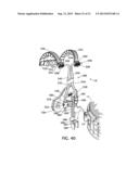 FREE FLOATING INTEGRATED LUG BRIDGE diagram and image