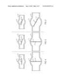 THROTTLE VALVE SYSTEM FOR AN ENGINE diagram and image