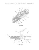 ACTIVE WEDGE AND I-BEAM FOR SURGICAL STAPLER diagram and image