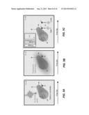 PHOTON INDUCED NEAR FIELD ELECTRON MICROSCOPE AND BIOLOGICAL IMAGING     SYSTEM diagram and image