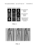 FRESH BLOOD IMAGING (FBI) WITH INDEPENDENTLY CONTROLLED MRI DATA     ACQUISITION PARAMETERS FOR DIASTOLIC AND SYSTOLIC MRI ACQUISITION     SUB-SEQUENCES diagram and image