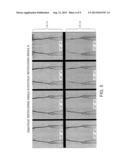 FRESH BLOOD IMAGING (FBI) WITH INDEPENDENTLY CONTROLLED MRI DATA     ACQUISITION PARAMETERS FOR DIASTOLIC AND SYSTOLIC MRI ACQUISITION     SUB-SEQUENCES diagram and image