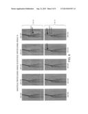 FRESH BLOOD IMAGING (FBI) WITH INDEPENDENTLY CONTROLLED MRI DATA     ACQUISITION PARAMETERS FOR DIASTOLIC AND SYSTOLIC MRI ACQUISITION     SUB-SEQUENCES diagram and image