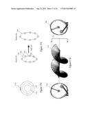 CHANNEL BONDING WITH ORBITAL ANGULAR MOMENTUM diagram and image