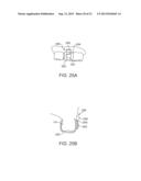 DENTAL BONE CONDUCTION HEARING APPLIANCE diagram and image