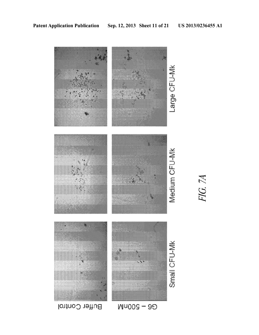 COMPOSITIONS AND METHODS COMPRISING GLYCYL-tRNA SYNTHETASES HAVING     NON-CANONICAL BIOLOGICAL ACTIVITIES - diagram, schematic, and image 12