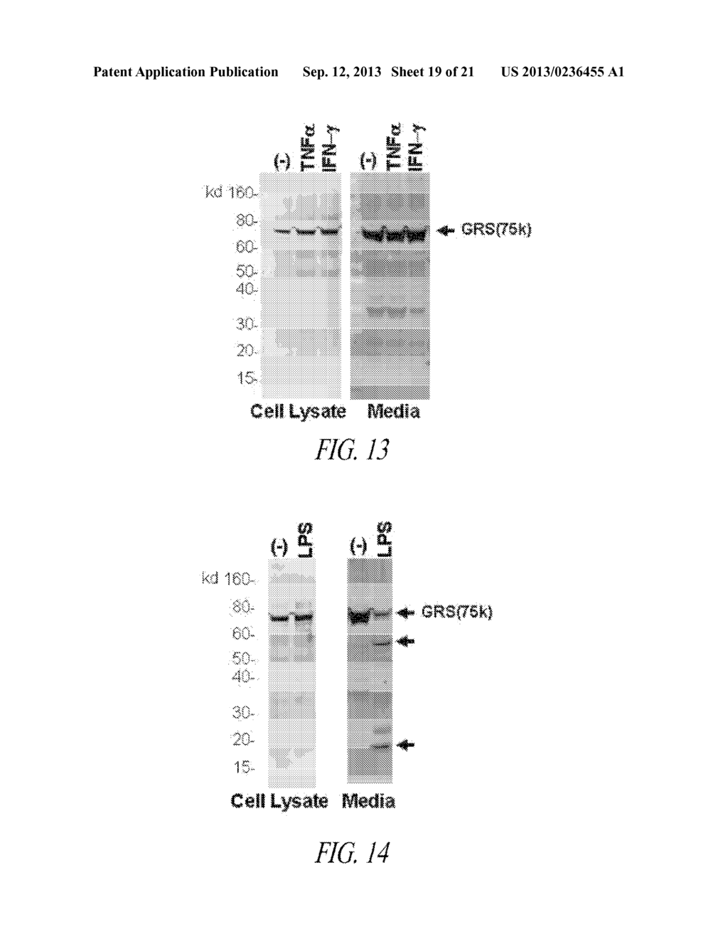 COMPOSITIONS AND METHODS COMPRISING GLYCYL-tRNA SYNTHETASES HAVING     NON-CANONICAL BIOLOGICAL ACTIVITIES - diagram, schematic, and image 20