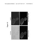 ANTI-CLTA4, ANTI-GLUT2 PROTEIN FOR THE TREATMENT OF TYPE 1 DIABETES diagram and image