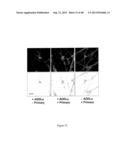 AMYLOID BETA-DERIVED DIFFUSIBLE LIGANDS (ADDLs), ADDL-SURROGATES,     ADDL-BINDING MOLECULES, AND USES THEREOF diagram and image