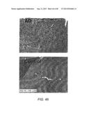 AMYLOID BETA-DERIVED DIFFUSIBLE LIGANDS (ADDLs), ADDL-SURROGATES,     ADDL-BINDING MOLECULES, AND USES THEREOF diagram and image