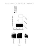 TRANSGLUTAMINASE 2 INHIBITORS FOR USE IN THE PREVENTION OR TREATMENT OF     RAPIDLY PROGRESSIVE GLOMERULONEPHRITIS diagram and image