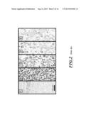 IMPLANTABLE MEDICAL DEVICES HAVING MICROPOROUS SURFACE LAYERS AND METHOD     FOR REDUCING FOREIGN BODY RESPONSE TO THE SAME diagram and image