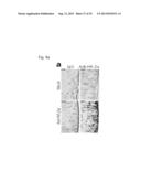 PHARMACEUTICAL COMPOSITION INCLUDING AN HIF-2 ALPHA INHIBITOR AS AN ACTIVE     INGREDIENT FOR PREVENTING OR TREATING ARTHRITIS diagram and image