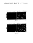 NANOTOPOGRAPHY-MEDIATED REVERSE UPTAKE PLATFORM FOR NUCLEIC ACID DELIVERY     AND APPLICATIONS THEREOF diagram and image