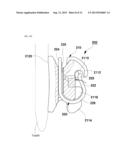 SELF-LIGATION ORTHODONTIC BRACKET diagram and image