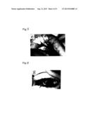 Vascularization Inhibitors diagram and image