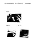 Vascularization Inhibitors diagram and image