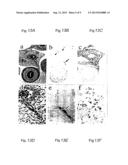 Vascularization Inhibitors diagram and image