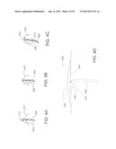 DEVICES AND METHODS FOR ASSISTING CARDIAC FUNCTION diagram and image