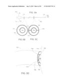 DEVICES AND METHODS FOR ASSISTING CARDIAC FUNCTION diagram and image