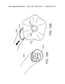 DEVICES AND METHODS FOR ASSISTING CARDIAC FUNCTION diagram and image