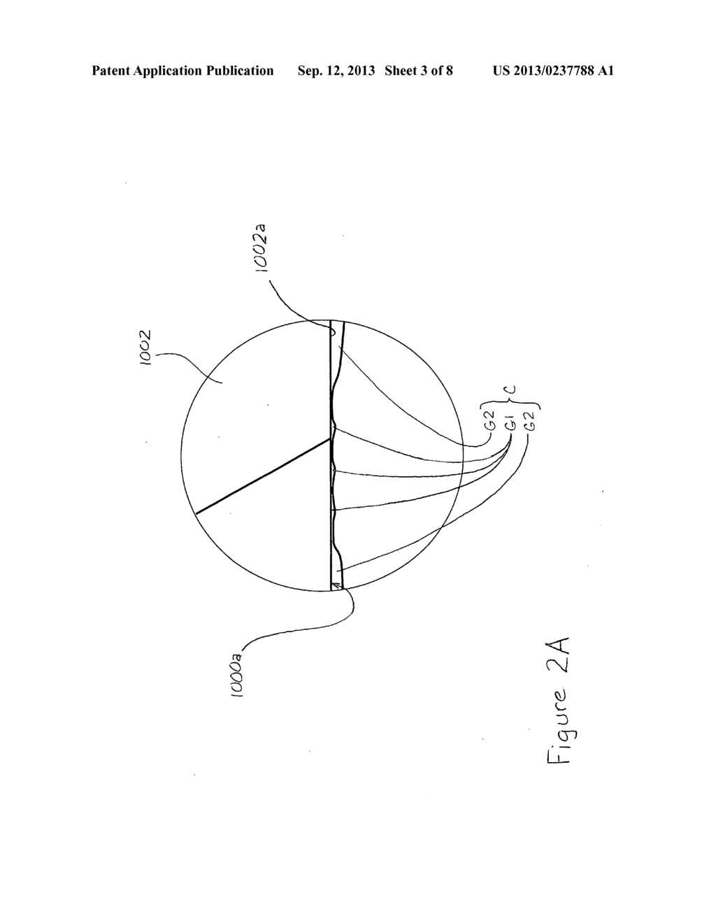 Apparatus and Method for Mitigating Noise Affecting a Transcutaneous     Signal - diagram, schematic, and image 04