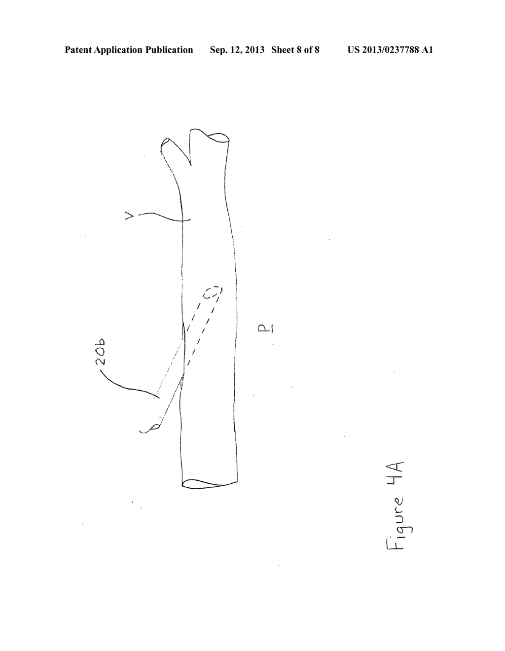 Apparatus and Method for Mitigating Noise Affecting a Transcutaneous     Signal - diagram, schematic, and image 09