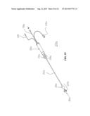 System and methods for locating and ablating arrhythomogenic tissues diagram and image