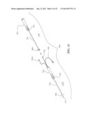 System and methods for locating and ablating arrhythomogenic tissues diagram and image